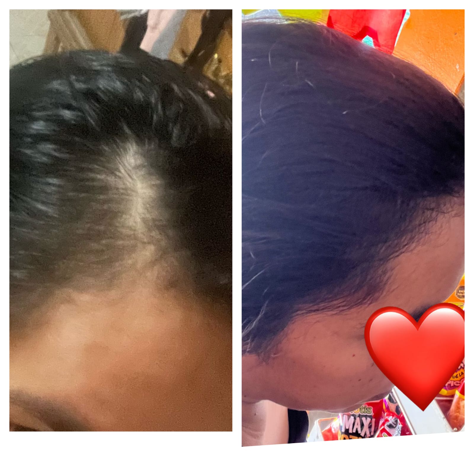 Antes y después piel rostro