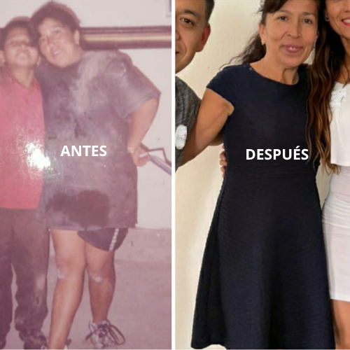 Antes y después piel rostro